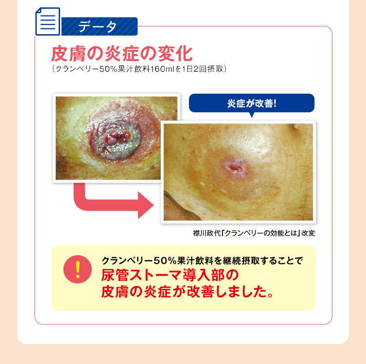 皮膚の炎症の変化の図